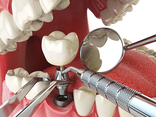 Best Walk-In Emergency Dentist in Deerfield, IL
